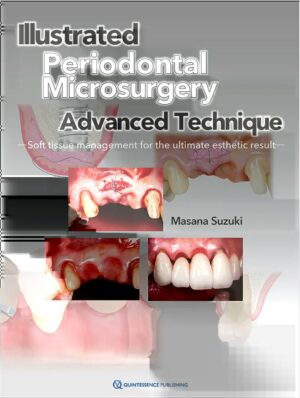 Illustrated Advanced Technique of Periodontal Microsurgery