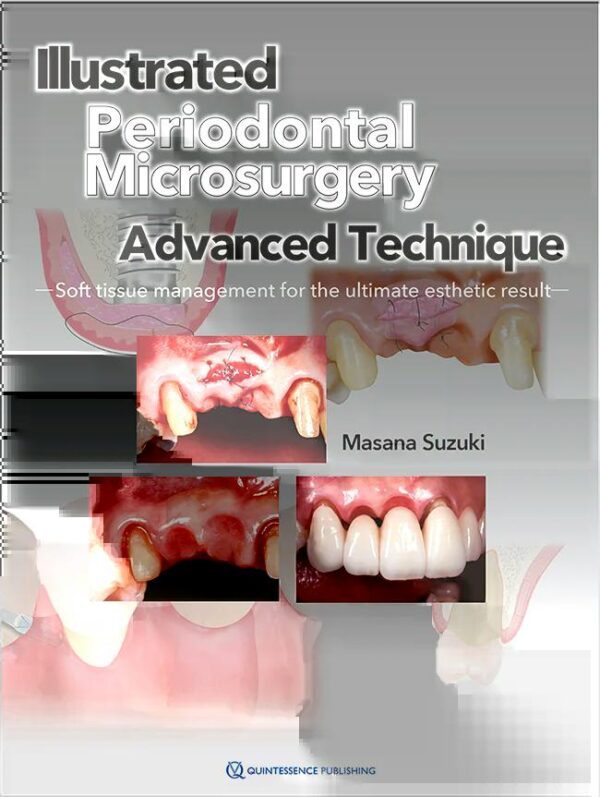 Illustrated Advanced Technique of Periodontal Microsurgery
