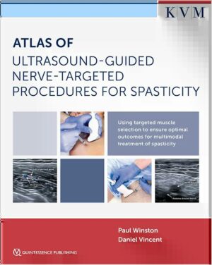 Atlas of Ultrasound-Guided Nerve-Targeted Procedures for Spasticity