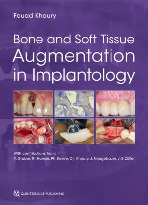 Bone and Soft Tissue Augmentation in Implantology