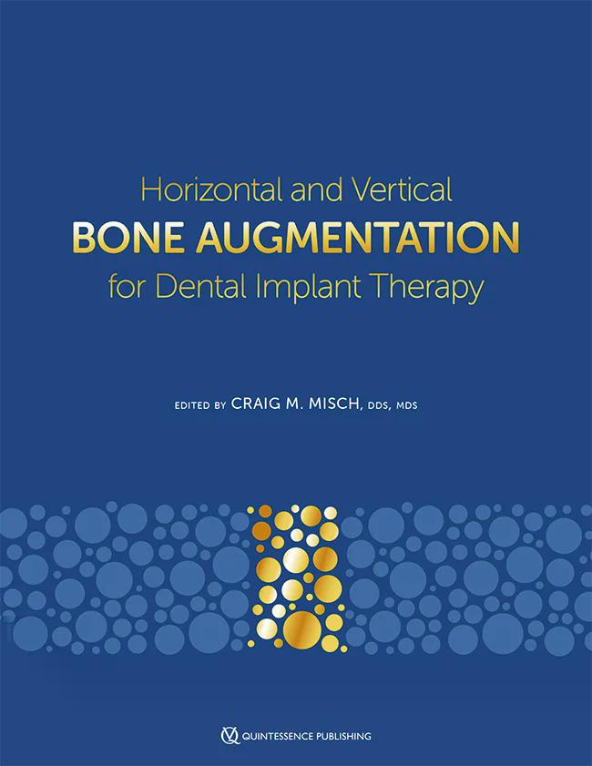 Horizontal and Vertical Bone Augmentation for Dental Implant Therapy