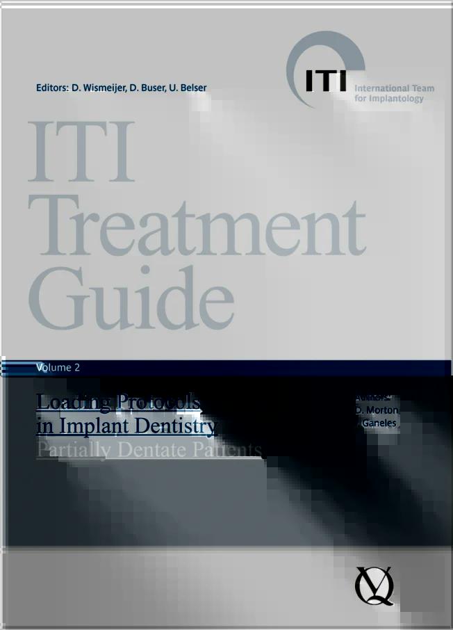 ITI Treatment Guide Volume 2: Loading Protocols in Implant