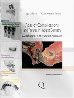 Atlas of Complications and Failures in Implant Dentistry