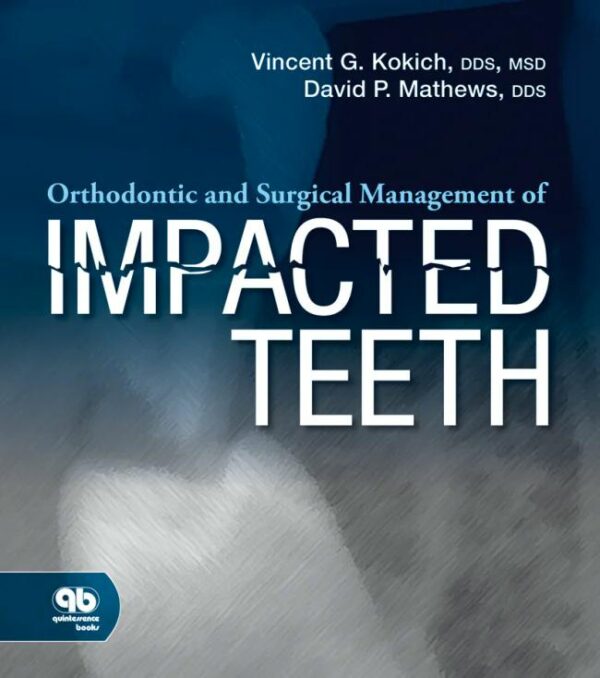 Orthodontic and Surgical Management of Impacted Teeth