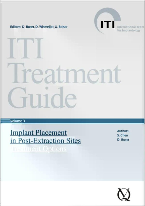 Implant Placement in Post-Extraction Sites