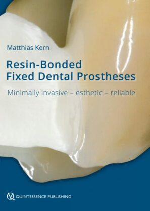 Resin-Bonded Fixed Dental Prostheses