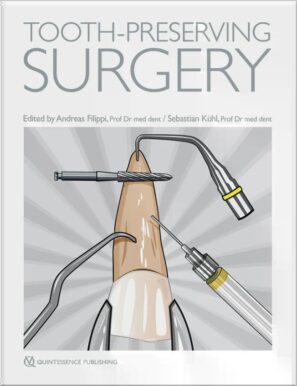 Tooth-Preserving Surgery