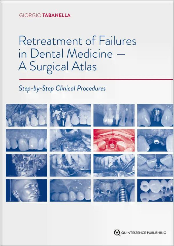 Retreatment of Failures in Dental Medicine - A Surgical Atlas
