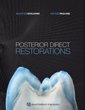 Posterior Direct Restorations