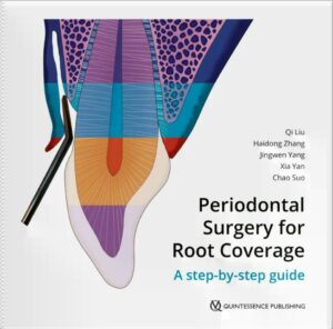 Periodontal Surgery for Root Coverage
