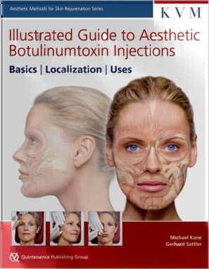 Illustrated Guide to Aesthetic Botulinumtoxin Injections