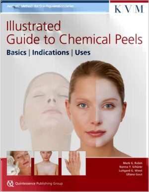 Illustrated Guide to Chemical Peels