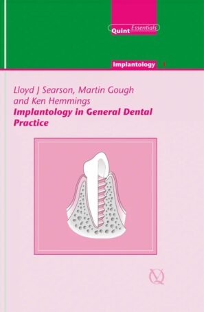 Implantology in General Dental Practice