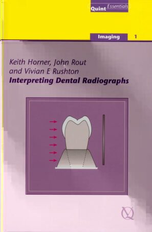Interpreting Dental Radiographs