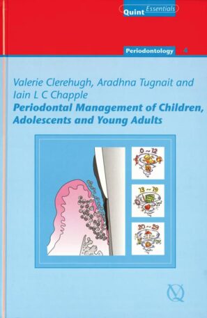 Periodontal Management of Children, Adolescents and Young Adults