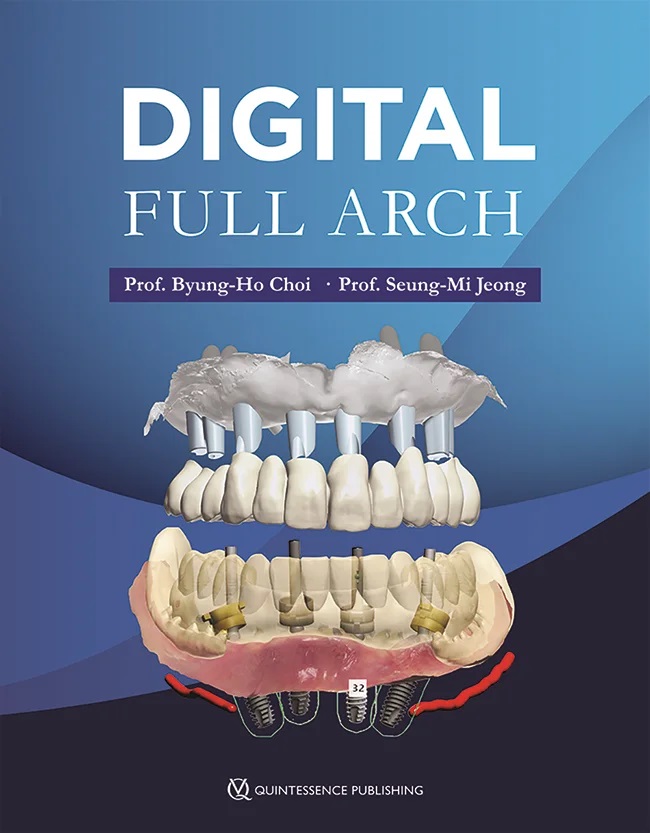 Digital Full Arch