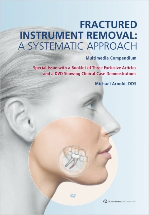 Fractured Instrument Removal