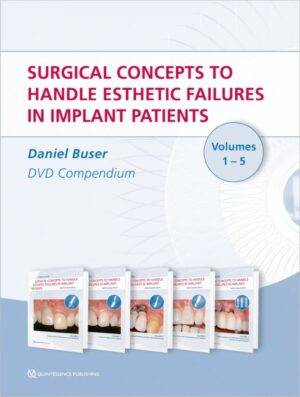 Surgical concepts to handle esthetic failures in implant patients