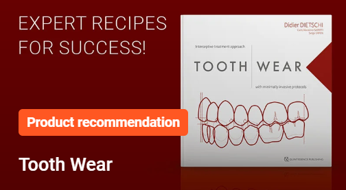 Tooth Wear