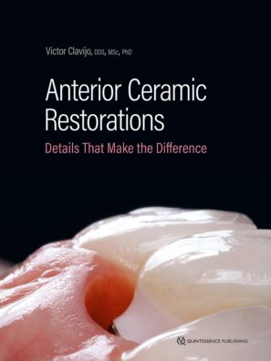 Victor Clavijo Anterior Ceramic Restorations