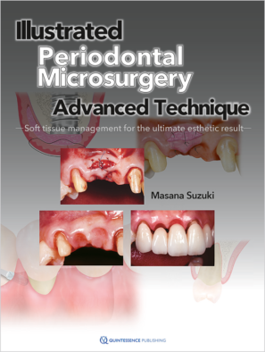 Illustrated Advanced Technique of Periodontal Microsurgery
