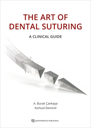 The Art of Dental Suturing