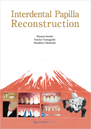 Interdental Papilla Reconstruction