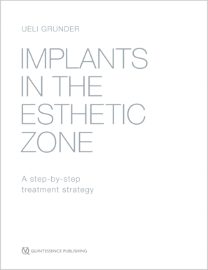 Implants in the Esthetic Zone