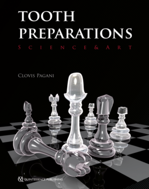 Tooth Preparations