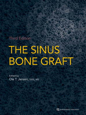 The Sinus Bone Graft