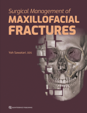 Surgical Management of Maxillofacial Fractures