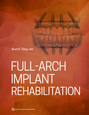 Full-Arch Implant Rehabilitation