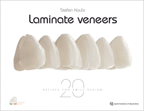 Laminate Veneers