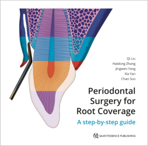 Periodontal Surgery for Root Coverage