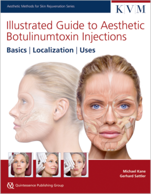 Illustrated Guide to Aesthetic Botulinumtoxin Injections