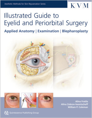 Illustrated Guide to Eyelid and Periorbital Surgery