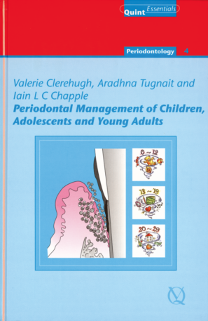 Periodontal Management of Children, Adolescents and Young Adults
