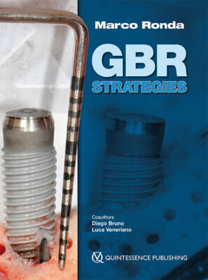 GBR strategies